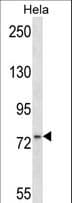 Polyclonal Rabbit anti-Human MSN / Moesin Antibody (aa459-487, WB)