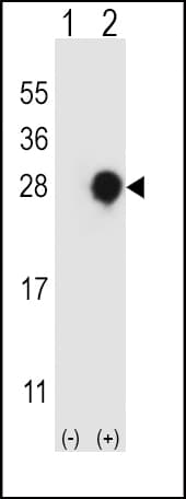 RGS4 Antibody (aa147-174)