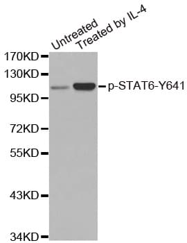 Polyclonal Rabbit anti-Human STAT6 Antibody (phospho-Tyr641, IHC, WB)