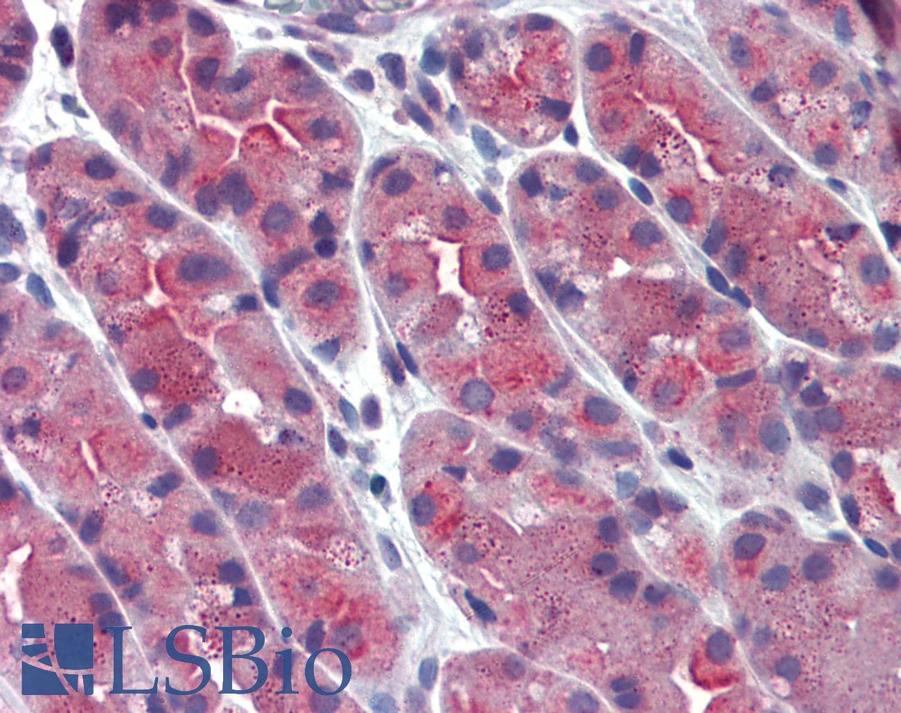IHC-plus™ Polyclonal Rabbit anti-Human ERP44 Antibody (Internal, IHC)