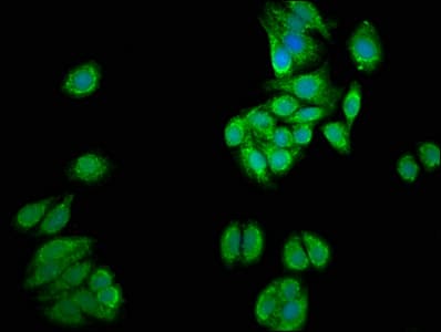 IHC-plus™ UGT1A / UGT1A1 Antibody