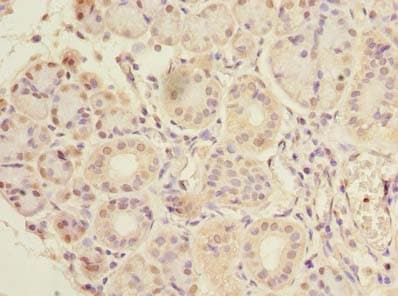 Polyclonal Rabbit anti-Human CCDC108 Antibody (Coiled-coil domain, IHC, WB)