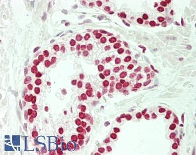 IHC-plus™ Polyclonal Rabbit anti-Human SOX5 Antibody (IHC, IF, WB)