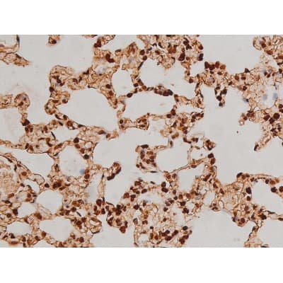 Polyclonal Rabbit anti-Human EZR / Ezrin Antibody (phospho-Tyr353, IF, WB)