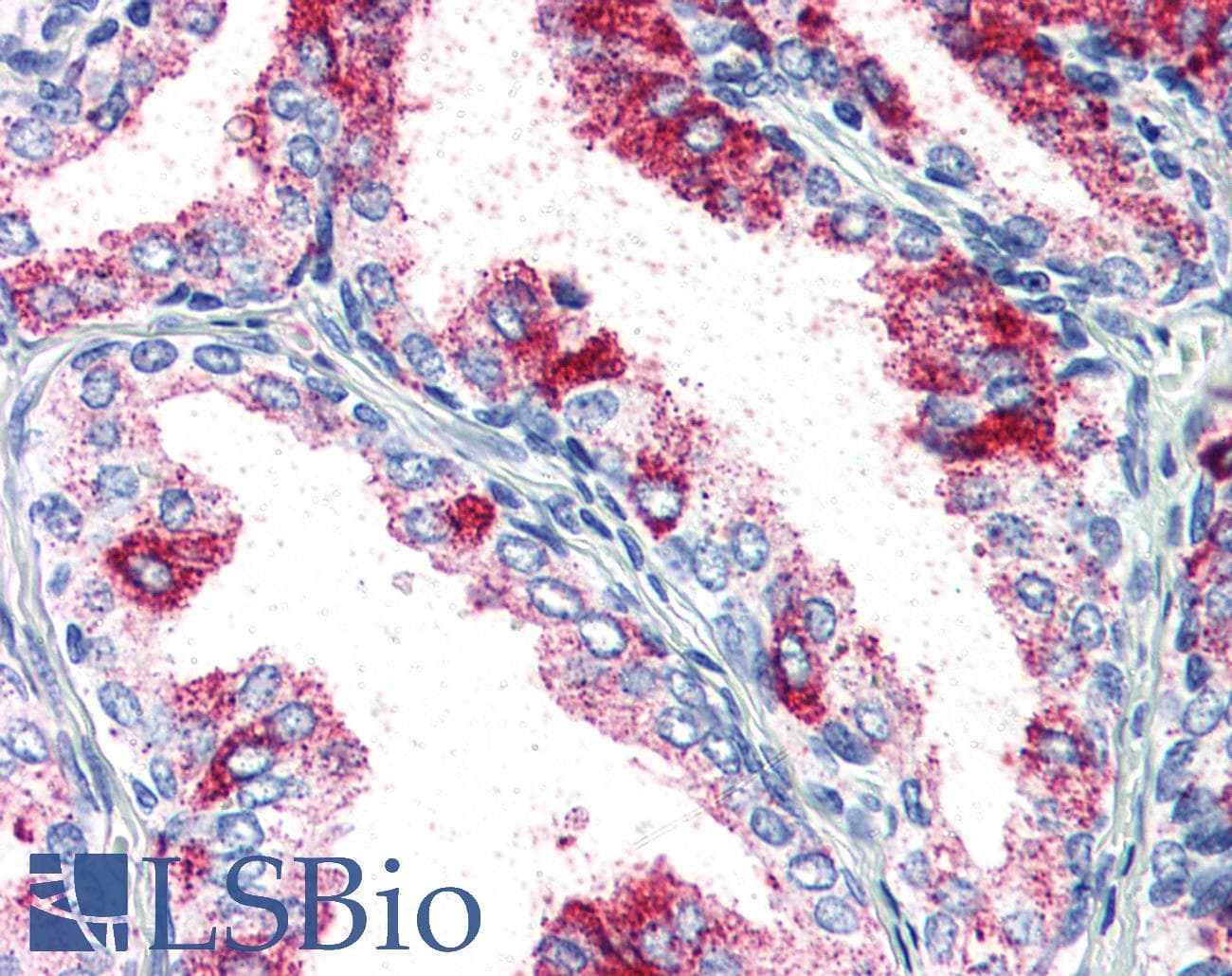 IHC-plus™ PRKCZ / PKC-Zeta Antibody (Cytoplasmic Domain)