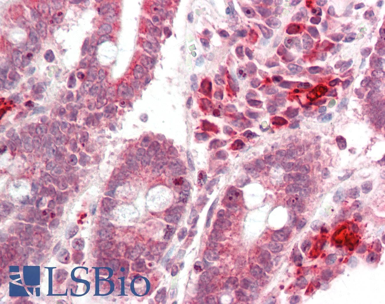 Polyclonal Rabbit anti-Human NSMCE4A / NSE4A Antibody (C-Terminus, IHC, WB)