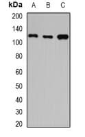 IHC-plus™ HIP1 Antibody
