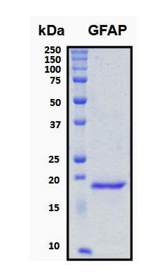 Human GFAP Protein (Recombinant His, N-Terminal)
