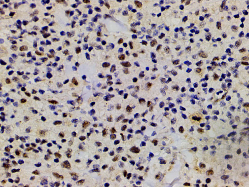 LIMK1 / LIMK Antibody (phospho-Thr508)