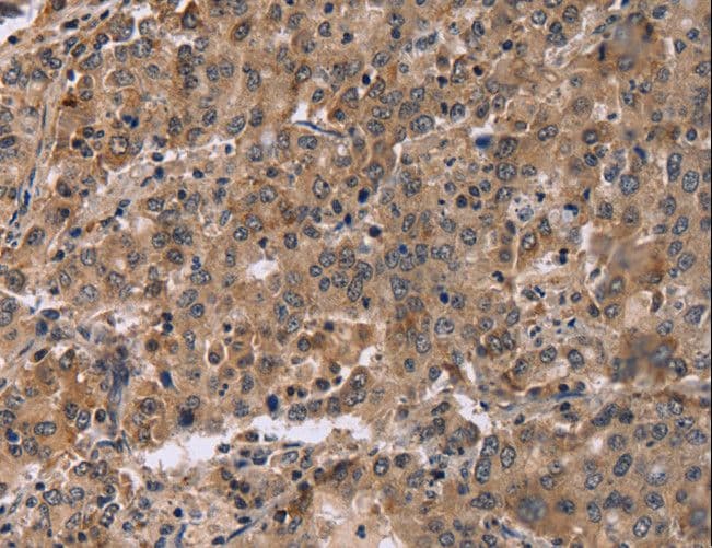 Polyclonal Rabbit anti-Human FAM107A / TU3A Antibody (IHC)