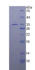 Human IRAK2 / IRAK-2 Protein (Recombinant His)