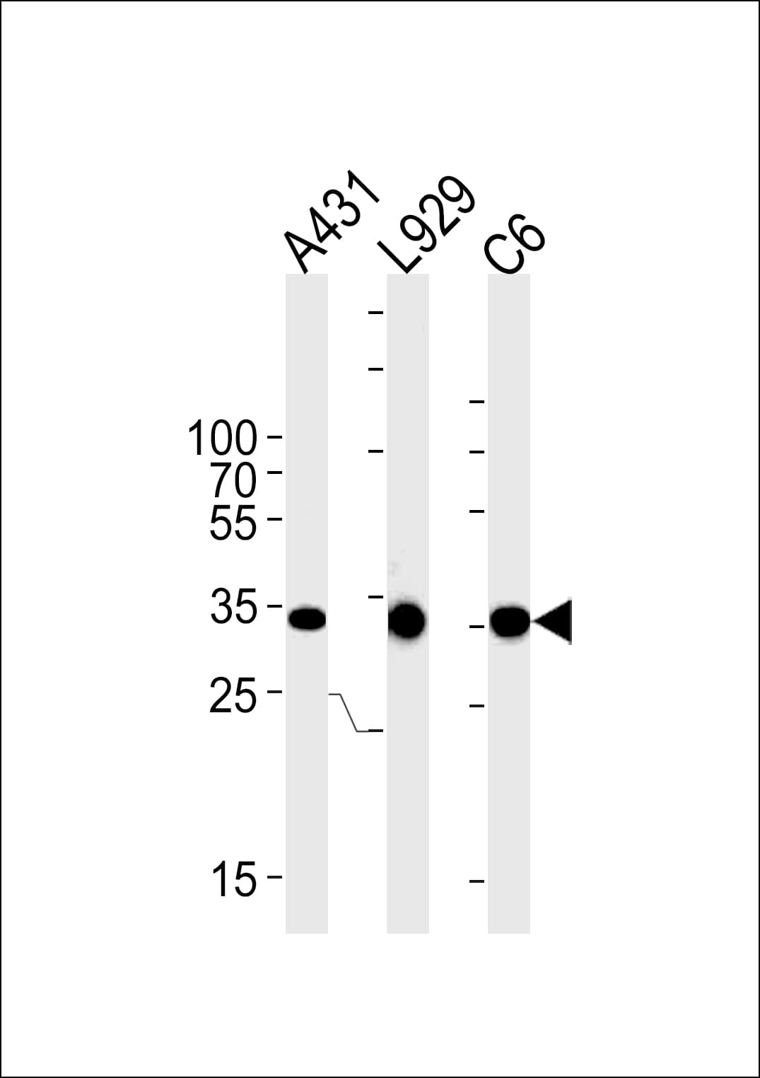 Polyclonal Rabbit anti-Human CCND1 / Cyclin D1 Antibody (aa264-292, WB)