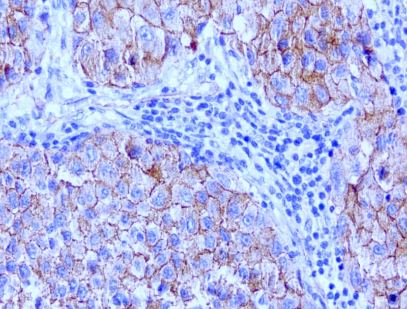CTNNB1 / Beta Catenin Antibody (clone UMAB15)