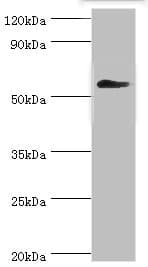 Polyclonal Rabbit anti-Human CCT3 Antibody (aa1-300, IHC, WB)