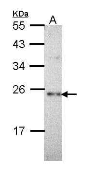 SLC9A1BP / CHP Antibody (aa47-141)