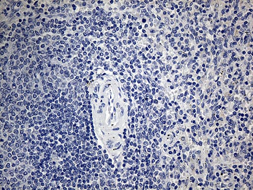 Monoclonal Mouse anti-Human ACAA1 Antibody (clone OTI4F1, IHC, WB)