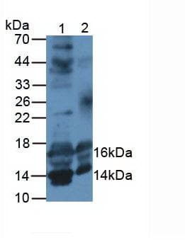 IGF1 Antibody (clone C1)