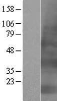 KRTAP4-2 Protein (Over-Expression Lysate Myc-DDK (Flag))