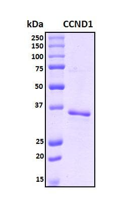 Human CCND1 / Cyclin D1 Protein (Recombinant His, N-Terminal)