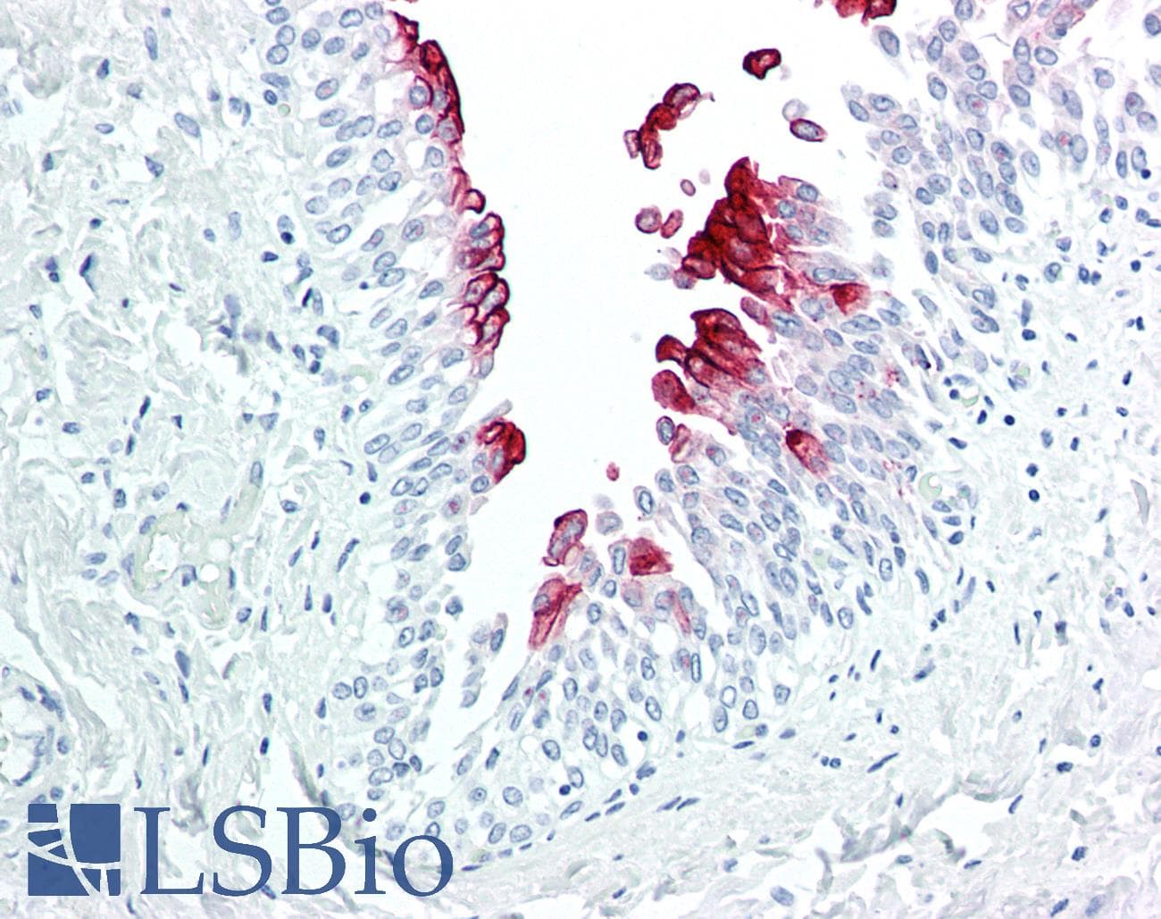PathPlus™ Monoclonal Mouse anti-Human UPK3A / UPK3 / Uroplakin III Antibody (IHC)