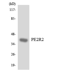 PTGER2 / EP2 Antibody (aa250-299)