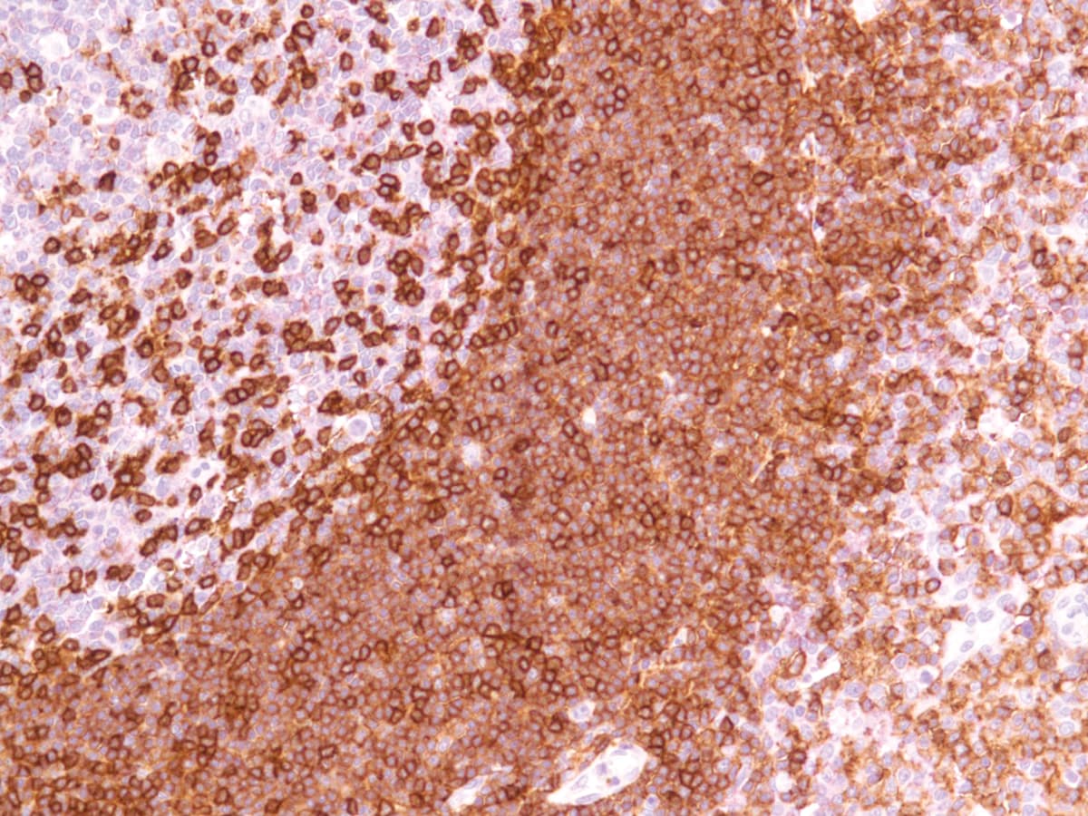 IHC-plus™ CD45R Antibody (Concentrated)