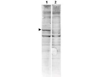 PathPlus™ Polyclonal Rabbit anti-Human CAMK2A / CaMKII Alpha Antibody (N-Terminus, IHC, WB)