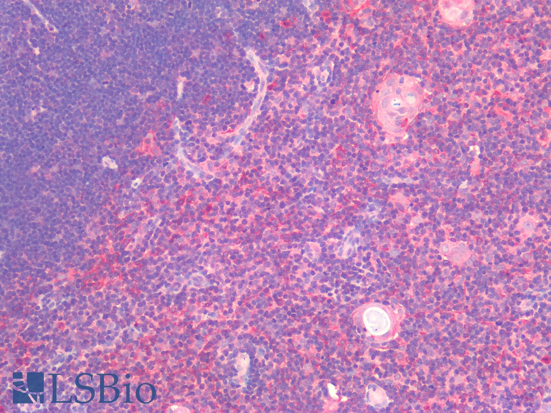 IHC-plus™ Polyclonal Rabbit anti-Human IL6 / Interleukin 6 Antibody (IHC)