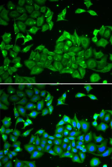 Polyclonal Rabbit anti-Human ALDH3A1 Antibody (IHC, IF, WB)