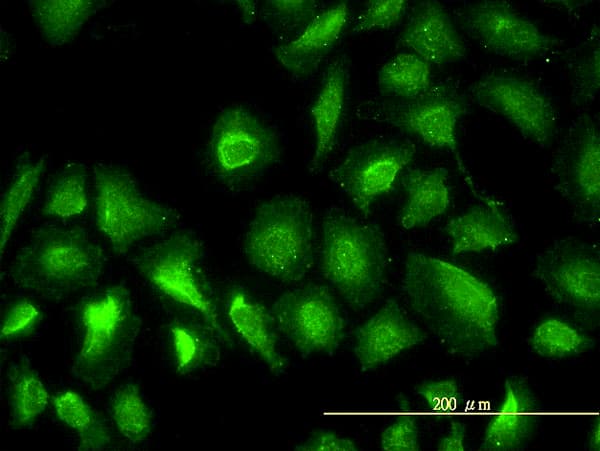PGM1 / Phosphoglucomutase 1 Antibody (clone 3B8-H4)