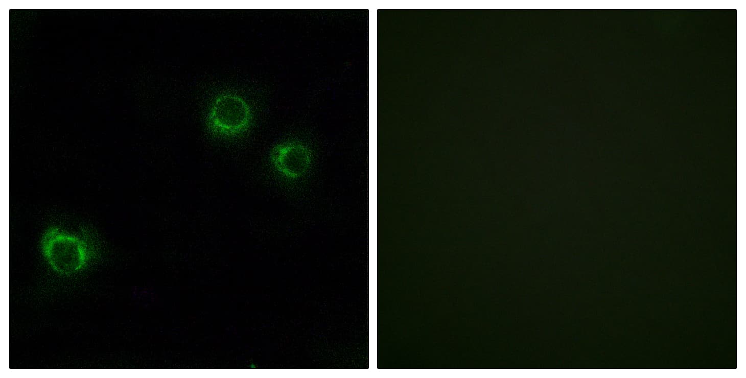 CLDN6 / Claudin 6 Antibody (aa81-130)