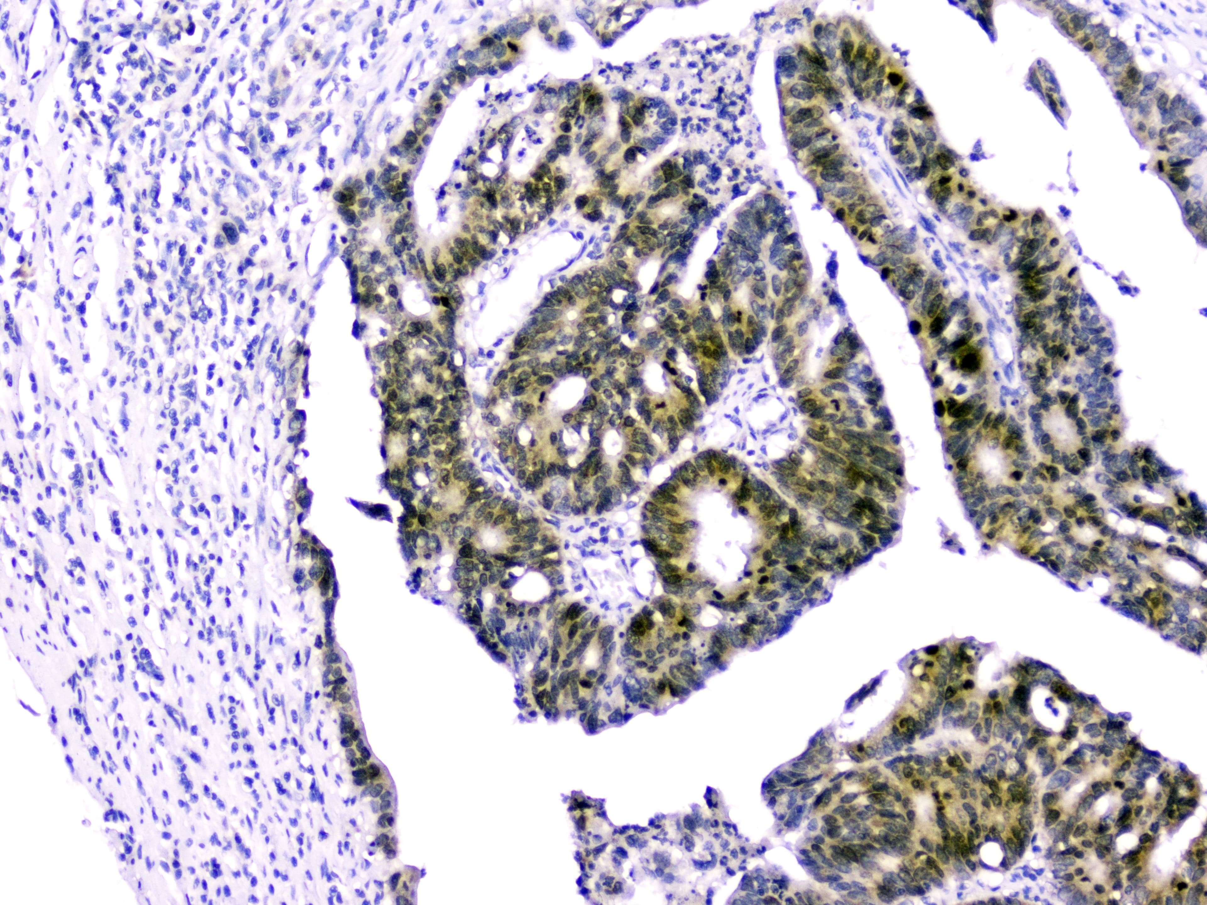 BIRC5 / Survivin Antibody