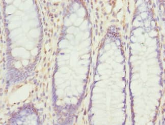 Polyclonal Rabbit anti-Human RPS6KL1 Antibody (IHC, WB)