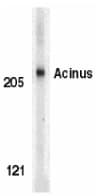 PathPlus™ Polyclonal Rabbit anti-Human ACIN1 / Acinus Antibody (IHC, IF, WB)