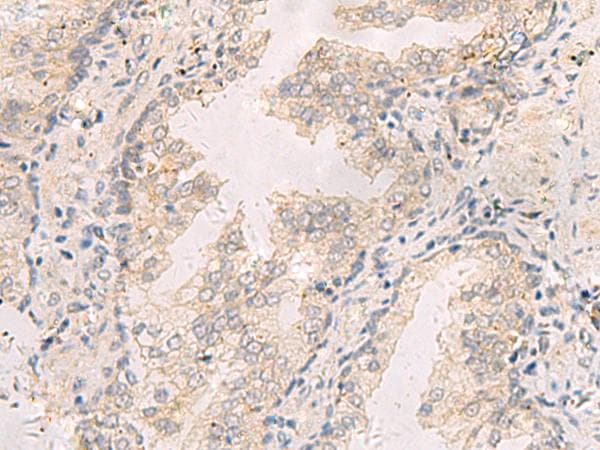 Polyclonal Rabbit anti-Human TNNT1 / TNT Antibody (IHC, WB)