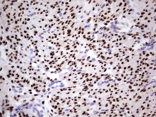 PR / Progesterone Receptor Antibody (aa1-298, clone OTI26C2, Carrier-free)