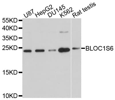 PLDN / Pallidin Antibody
