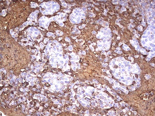 S100A9 / MRP14 Antibody (clone UMAB173)