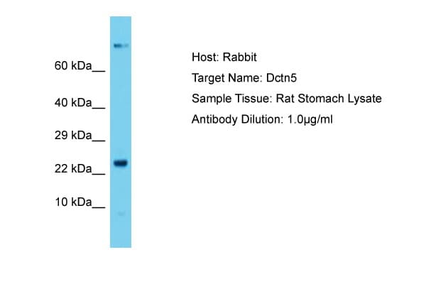 DCTN5 / Dynactin 5 Antibody (N-Terminus)