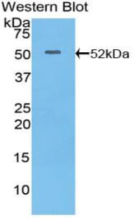 ITGA6/Integrin Alpha 6/CD49f Antibody (aa903-1073)