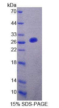 Rat FBLN7 / Fibulin 7 Protein (Recombinant His-T7, N-terminus)