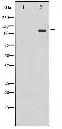 RB1 / Retinoblastoma / RB Antibody (phospho-Ser795)