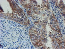 Monoclonal Mouse anti-Human SENP2 Antibody (clone OTI6F1, IHC, IF, WB)
