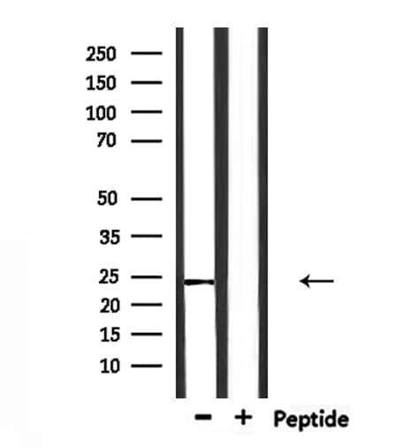 Claudin 20 / CLDN20 Antibody