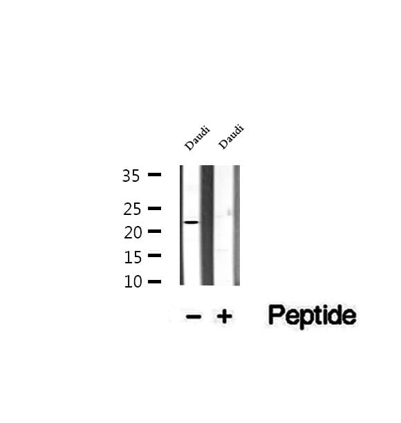 Polyclonal Rabbit anti-Human MIA40 / CHCHD4 Antibody (IHC, IF, WB)
