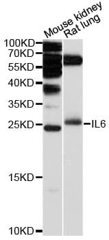 IL6 / Interleukin 6 Antibody