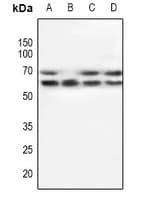 Polyclonal Rabbit anti-Human POTEG Antibody (IHC, WB)