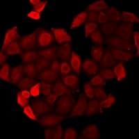 Polyclonal Rabbit anti-Human CSRP3 Antibody (IF, WB)