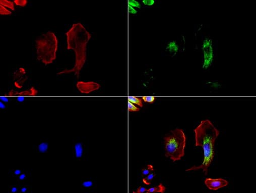 GFAP Antibody (clone UMAB5, Carrier-free)
