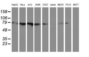 IHC-plus™ Monoclonal Mouse anti-Human Complement C1s Antibody (clone 4D9, IHC, WB)
